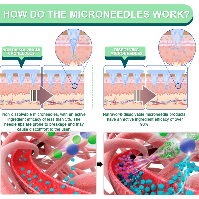 ❤️【Last Day Promotion 60% OFF】Natravor® NIDDK-Tirzepatide Slimming & health NANO MICRONEEDLE PATCH👨⚕️(Zero Pain, 24/7 Release | Lose 20lbs FAST | 90% Sugar Drop | )