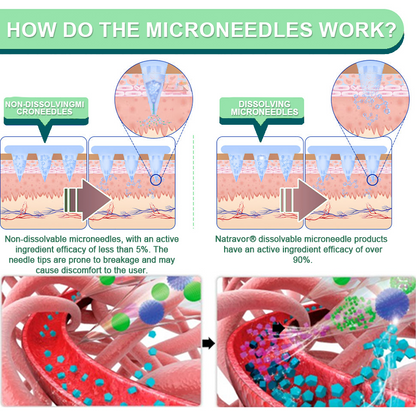 ❤️【Last Day Promotion 60% OFF】Natravor® NIDDK-Tirzepatide Slimming & health NANO MICRONEEDLE PATCH👨‍⚕️（Zero Pain, 24/7 Release | Lose 20lbs FAST | 90% Sugar Drop | ）